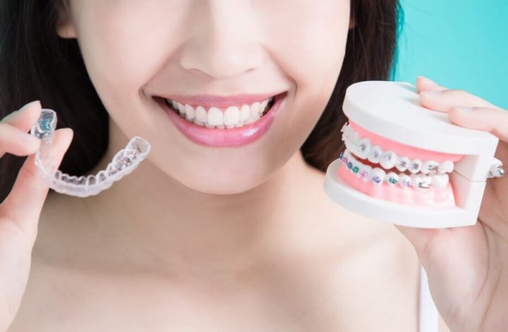 Choose Right for You: Braces or Invisalign
